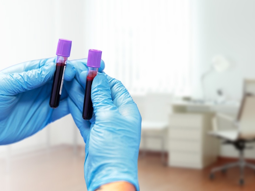 Odběrový box - poliklinika Vlašim - Nemocnice Rudolfa a Stefanie Benešov